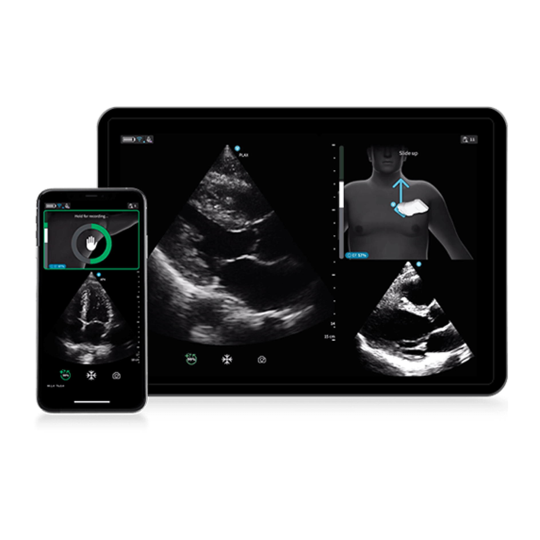 Caption AI™ for Vscan Air™ SL Caption AI™ for Vscan Air™ SL